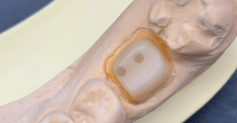 ファイバーコア