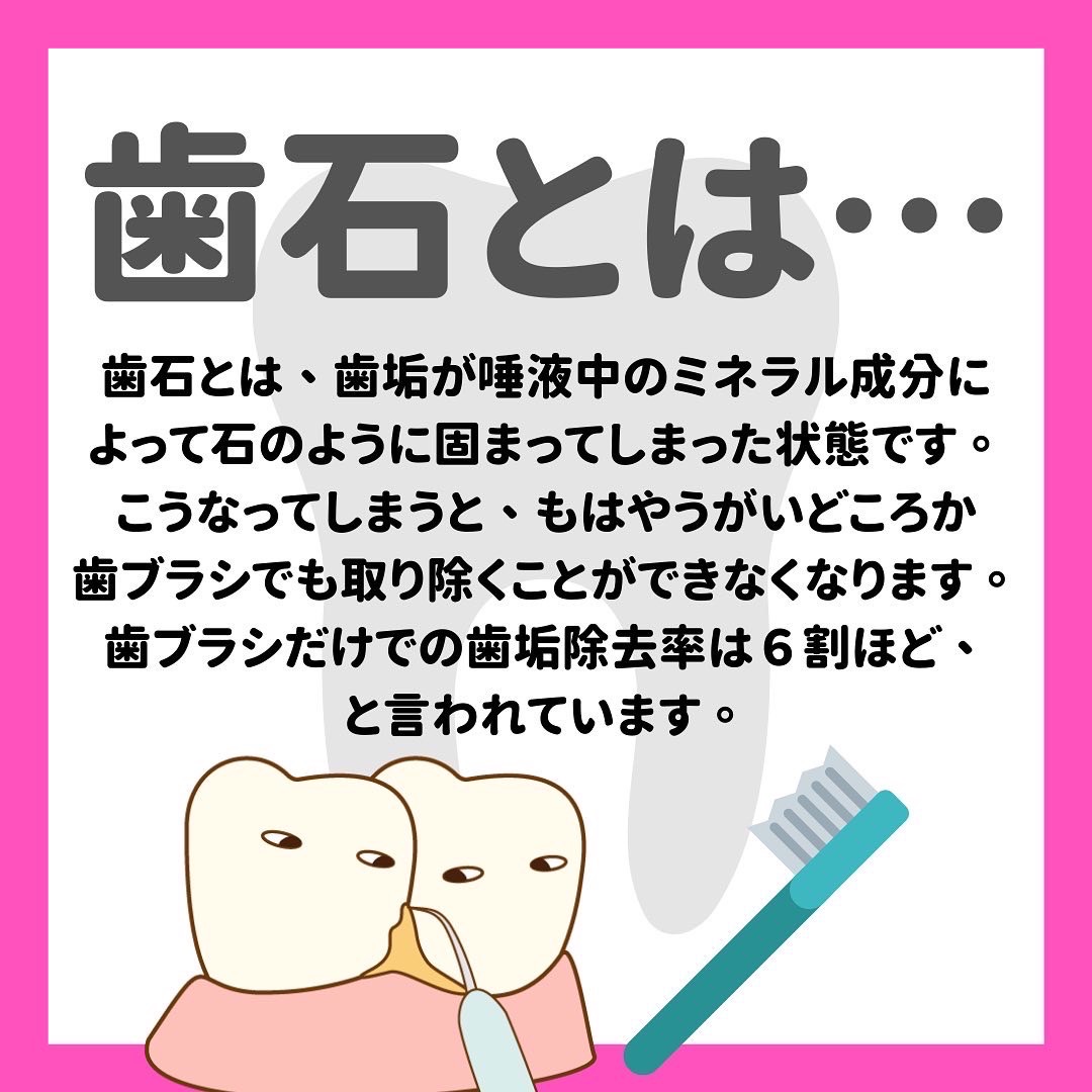 歯石原因と対策 | 歯石はなぜつくのか – WWCLKV